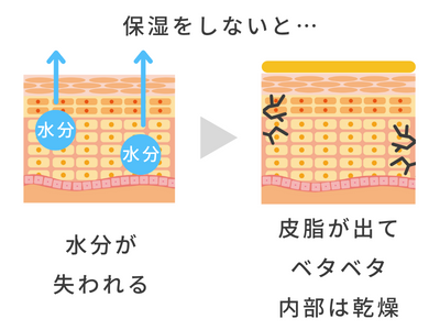 スキンケア 乾燥 ベタベタ