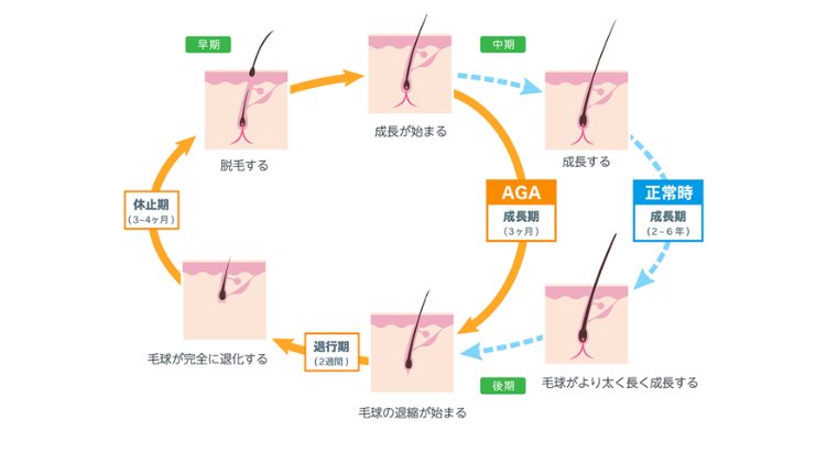 髪の毛の周期（ヘアサイクル）