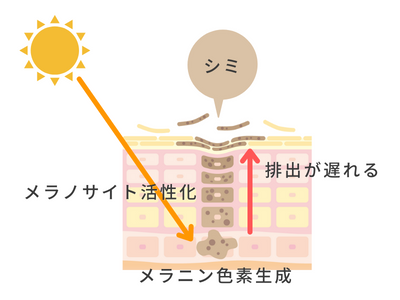 シミ メカニズム