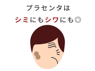 シミ プラセンタ