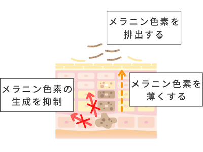 シミ ビタミンC誘導体