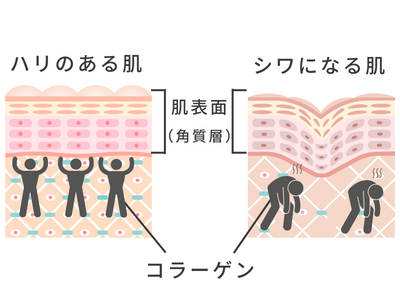 コラーゲン シワ