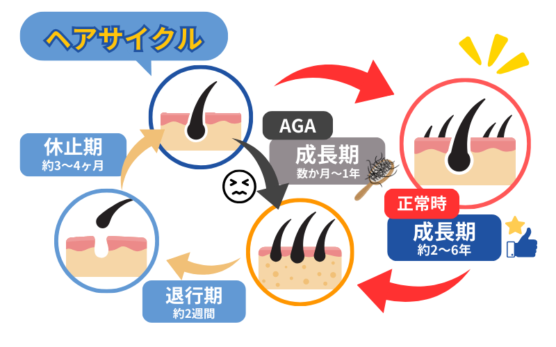 薄毛になるメカニズム