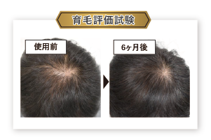 比較画像を挿入
