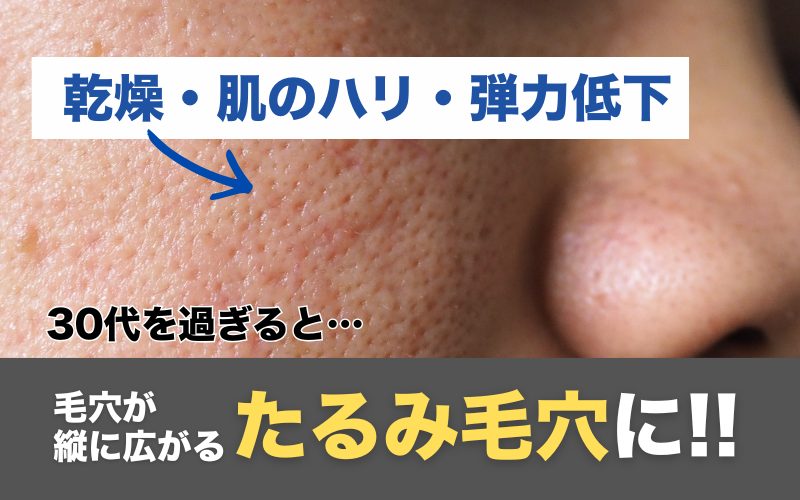 毛穴の開きの原因を示す比較図：左側に若い肌（コラーゲン豊富でハリがあり毛穴が小さい断面図）、右側に30代以降の肌（コラーゲン減少でハリが低下し毛穴が縦に開いたたるみ毛穴の断面図）を並べた比較イラスト