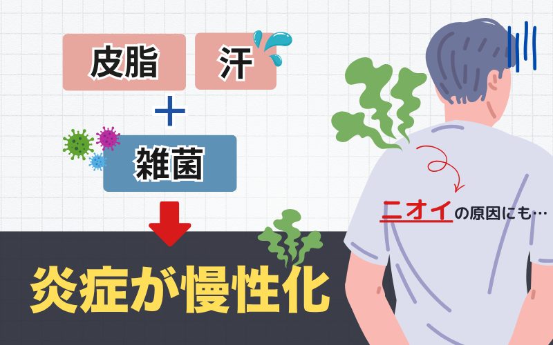 肌荒れの原因