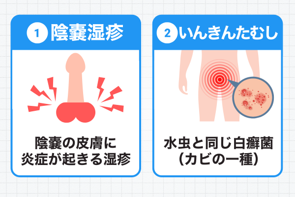 デリケートゾーン かゆみ 原因