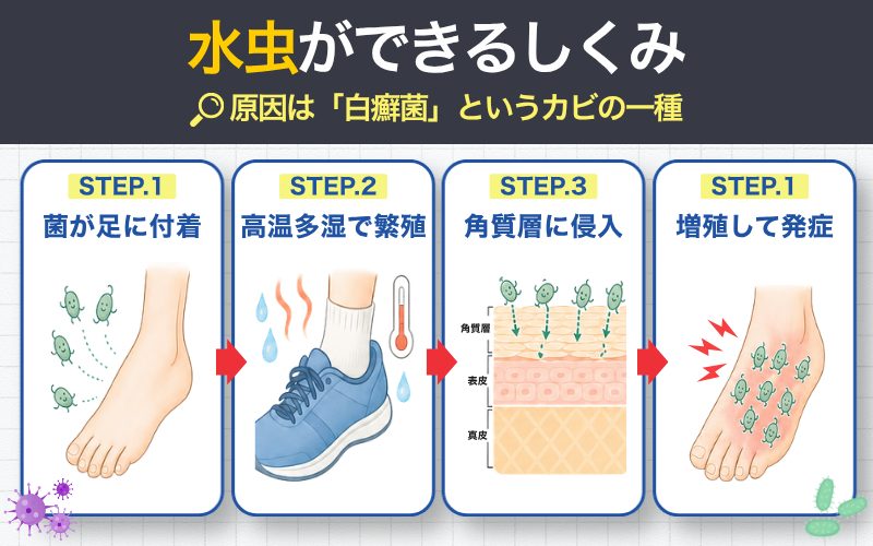 水虫ができるしくみ