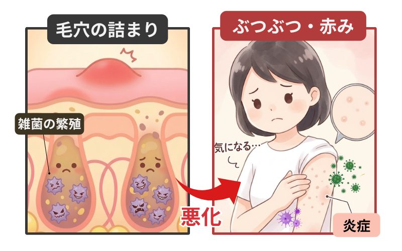 二の腕のぶつぶつの原因