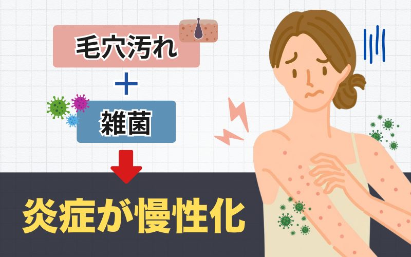 毛穴汚れと雑菌で炎症が慢性化する