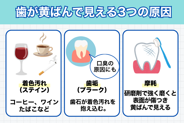 歯が黄ばんで見える3つの原因（着色汚れ・歯垢・摩耗）