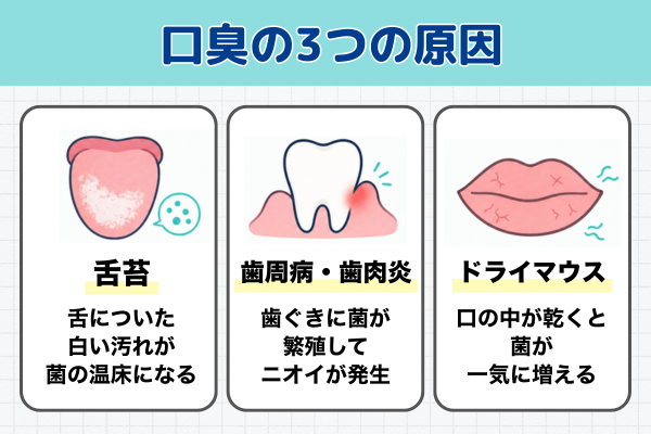 口臭の原因を示すイメージ