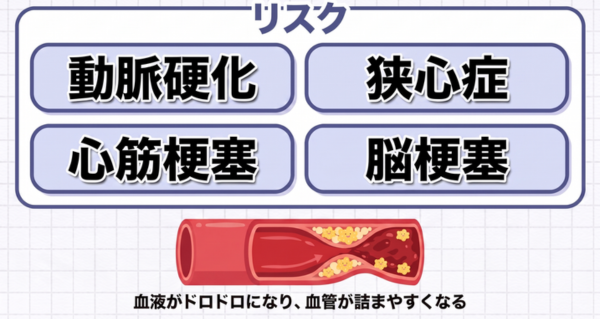 数値が高い状態が続くとLDLコレステロールが血管の壁に入り込み、血管が硬く狭くなる動脈硬化。詰まると狭心症・心筋梗塞・脳梗塞につながる。血糖値が高いままだと糖尿病に進み、目・腎臓・神経の合併症を招く