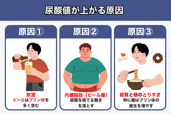 尿酸値が上がる原因3つ：①飲酒（ビールはプリン体を多く含む）、②内臓脂肪（ビール腹）は尿酸を捨てる働きを落とす、③脂質と糖のとりすぎ（特に糖はプリン体の産生を増やす）